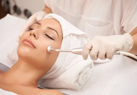 Microdermabrasion