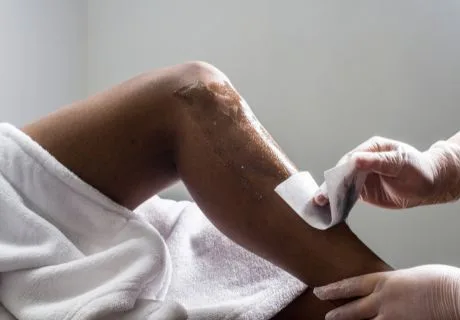 Leg Wax